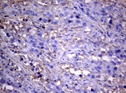PIK3C2A Mouse anti-Human, Clone: OTI3H2, lyophilized, TrueMAB 100 &mu;g;