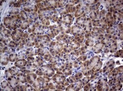 PIK3C2A Mouse anti-Human, Clone: OTI3H2, lyophilized, TrueMAB 100 &mu;g;
