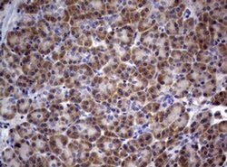 PIK3C2A Monoclonal Antibody (OTI3H2), TrueMAB , OriGene 100 &mu;L; Unconjugated:Antibodies,