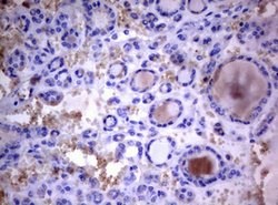 PIK3C2A Mouse anti-Human, Clone: OTI3H2, lyophilized, TrueMAB 100 &mu;g;