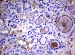 PIK3C2A Monoclonal Antibody (OTI3H2), TrueMAB , OriGene 100 &mu;L; Unconjugated:Antibodies,