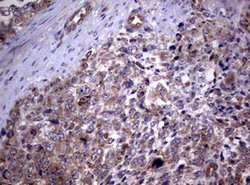 PIK3C2A Mouse anti-Human, Clone: OTI3H2, lyophilized, TrueMAB 100 &mu;g;