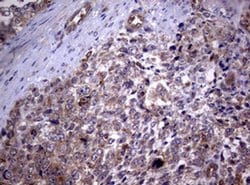 PIK3C2A Monoclonal Antibody (OTI3H2), TrueMAB , OriGene 100 &mu;L; Unconjugated:Antibodies,