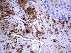 PIK3C2A Mouse anti-Human, Clone: OTI3H2, lyophilized, TrueMAB 100 &mu;g;