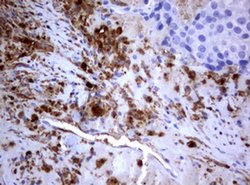 PIK3C2A Monoclonal Antibody (OTI3H2), TrueMAB , OriGene 100 &mu;L; Unconjugated:Antibodies,