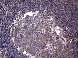 PIK3C2A Mouse anti-Human, Clone: OTI3H2, lyophilized, TrueMAB 100 &mu;g;