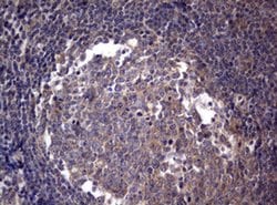 PIK3C2A Monoclonal Antibody (OTI3H2), TrueMAB , OriGene 100 &mu;L; Unconjugated:Antibodies,
