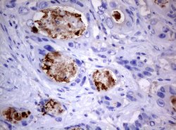 PIK3C2A Mouse anti-Human, Clone: OTI3H2, lyophilized, TrueMAB 100 &mu;g;