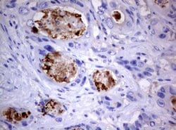 PIK3C2A Monoclonal Antibody (OTI3H2), TrueMAB , OriGene 100 &mu;L; Unconjugated:Antibodies,