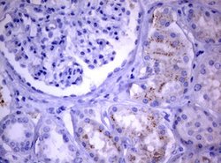 PIK3C2A Mouse anti-Human, Clone: OTI3H2, lyophilized, TrueMAB 100 &mu;g;