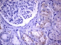 PIK3C2A Monoclonal Antibody (OTI3H2), TrueMAB , OriGene 100 &mu;L; Unconjugated:Antibodies,