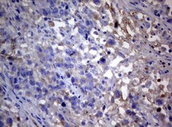 PIK3C2A Monoclonal Antibody (OTI3D9), TrueMAB , OriGene 100 &mu;L; Unconjugated:Antibodies,