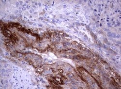 PIK3C2A Monoclonal Antibody (OTI4H9), TrueMAB , OriGene:Antibodies:Primary