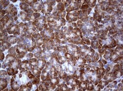 PIK3C2A Monoclonal Antibody (OTI4H9), TrueMAB , OriGene 100 &mu;L; Unconjugated:Antibodies,