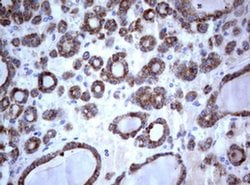 PIK3C2A Monoclonal Antibody (OTI4H9), TrueMAB , OriGene 100 &mu;L; Unconjugated:Antibodies,