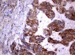 PIK3C2A Monoclonal Antibody (OTI4H9), TrueMAB , OriGene 100 &mu;L; Unconjugated:Antibodies,