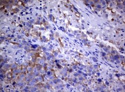 PIK3C2A Monoclonal Antibody (OTI1B8), TrueMAB , OriGene 100 &mu;L; Unconjugated:Antibodies,