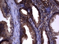 PIK3C2A Monoclonal Antibody (OTI4E6), TrueMAB , OriGene 100 &mu;L; Unconjugated:Antibodies,
