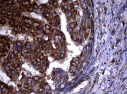 PIK3C2A Monoclonal Antibody (OTI4E6), TrueMAB , OriGene:Antibodies:Primary