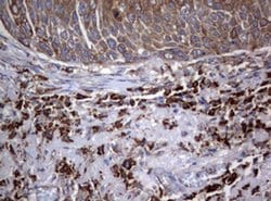 PIK3C2A Monoclonal Antibody (OTI2D9), TrueMAB , OriGene 100 &mu;L; Unconjugated:Antibodies,