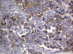 PIK3C2A Monoclonal Antibody (OTI2D9), TrueMAB , OriGene 100 &mu;L; Unconjugated:Antibodies,