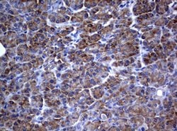 PIK3C2A Monoclonal Antibody (OTI2D9), TrueMAB , OriGene 100 &mu;L; Unconjugated:Antibodies,