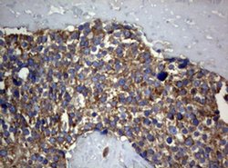 PIK3C2A Monoclonal Antibody (OTI2D9), TrueMAB , OriGene 100 &mu;L; Unconjugated:Antibodies,