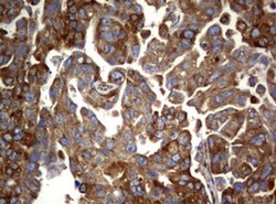 PIK3C2A Monoclonal Antibody (OTI2D9), TrueMAB , OriGene 100 &mu;L; Unconjugated:Antibodies,
