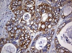 PIK3C2A Monoclonal Antibody (OTI2D9), TrueMAB , OriGene 100 &mu;L; Unconjugated:Antibodies,
