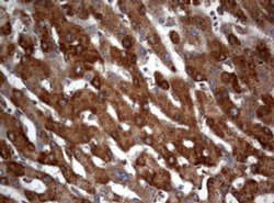 PIK3C2A Monoclonal Antibody (OTI2D9), TrueMAB , OriGene 100 &mu;L; Unconjugated:Antibodies,