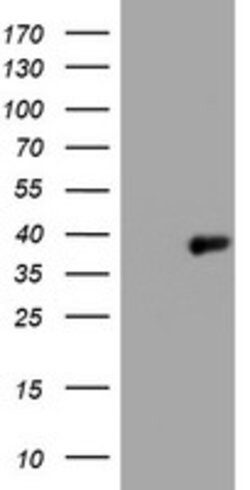 PIK3C2A Mouse anti-Human, Clone: OTI3G9, lyophilized, TrueMAB 100 &mu;g;