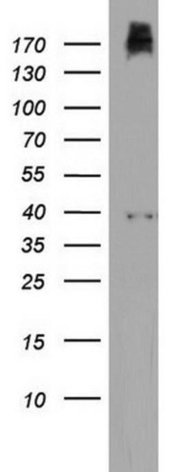 PIK3C2A Mouse anti-Human, Clone: OTI3H2, lyophilized, TrueMAB 100 &mu;g;