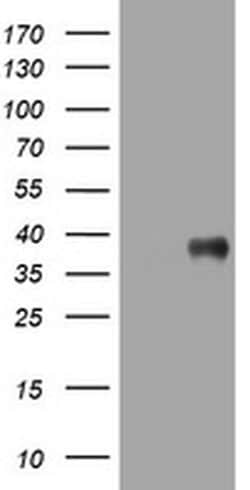 PIK3C2A Monoclonal Antibody (OTI4H9), TrueMAB , OriGene:Antibodies:Primary