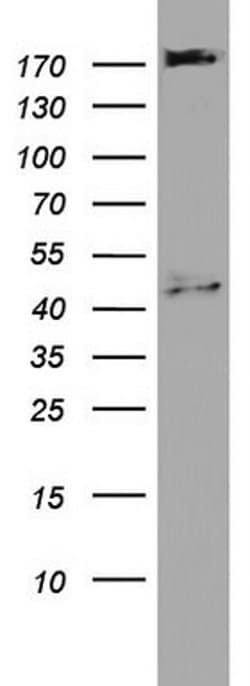 PIK3C2A Monoclonal Antibody (OTI4H9), TrueMAB , OriGene 100 &mu;L; Unconjugated:Antibodies,