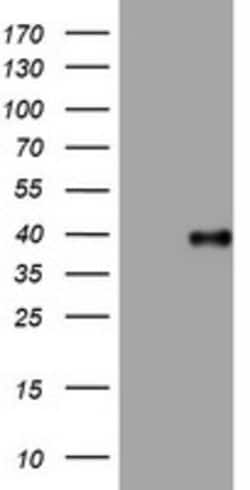 PIK3C2A Mouse anti-Human, Clone: OTI2B5, lyophilized, TrueMAB 100 &mu;g;