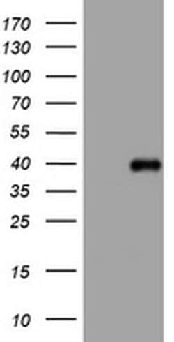 PIK3C2A Monoclonal Antibody (OTI4E6), TrueMAB , OriGene:Antibodies:Primary