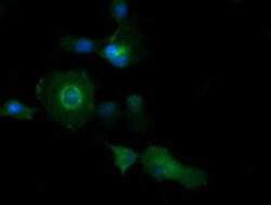 PIK3C2B Mouse anti-Human, Clone: OTI2G3, liquid, TrueMAB 100 &mu;L; Unconjugated:Antibodies,