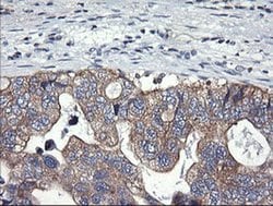 PIK3C2B Mouse anti-Human, Clone: OTI2G3, liquid, TrueMAB 100 &mu;L; Unconjugated:Antibodies,