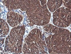 PIK3C2B Monoclonal Antibody (OTI3B1), TrueMAB , OriGene 100 &mu;L; Unconjugated:Antibodies,