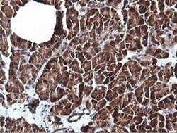 PIK3C2B Monoclonal Antibody (OTI3B1), TrueMAB , OriGene 100 &mu;L; Unconjugated:Antibodies,