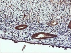 PIK3C2B Monoclonal Antibody (OTI3B1), TrueMAB , OriGene 100 &mu;L; Unconjugated:Antibodies,