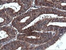 PIK3C2B Monoclonal Antibody (OTI3B1), TrueMAB , OriGene 100 &mu;L; Unconjugated:Antibodies,