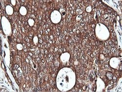 PIK3C2B Monoclonal Antibody (OTI3B1), TrueMAB , OriGene 100 &mu;L; Unconjugated:Antibodies,