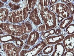 PIK3C2B Monoclonal Antibody (OTI3B1), TrueMAB , OriGene 100 &mu;L; Unconjugated:Antibodies,