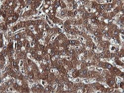 PIK3C2B Monoclonal Antibody (OTI3B1), TrueMAB , OriGene 100 &mu;L; Unconjugated:Antibodies,