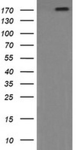 PIK3C2B Monoclonal Antibody (OTI3B1), TrueMAB , OriGene 100 &mu;L; Unconjugated:Antibodies,