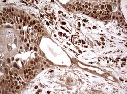 PIK3CA Monoclonal Antibody (OTI6D9), TrueMAB , OriGene 100 &mu;L; Unconjugated:Antibodies,