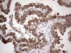 PIK3CA Monoclonal Antibody (OTI6D9), TrueMAB , OriGene:Antibodies:Primary