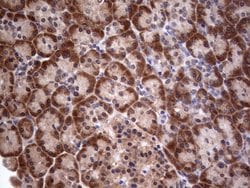 PIK3CA Monoclonal Antibody (OTI6D9), TrueMAB , OriGene 100 &mu;L; Unconjugated:Antibodies,