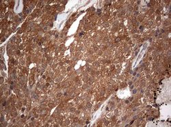 PIK3CA Monoclonal Antibody (OTI6D9), TrueMAB , OriGene 100 &mu;L; Unconjugated:Antibodies,